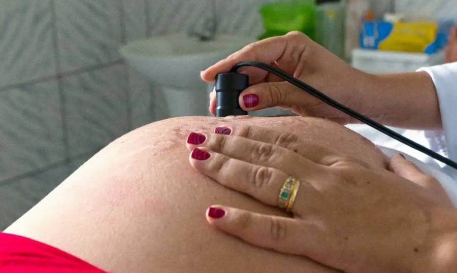 Leia mais sobre o artigo Saúde recomenda cálcio para todas as gestantes para prevenir eclâmpsia